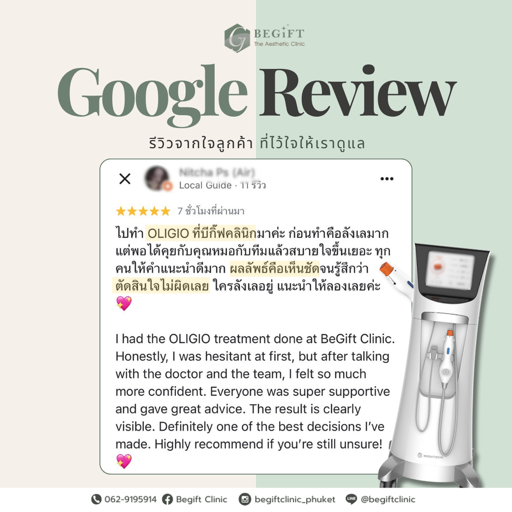 รีวิว Oligio Phuket | Begift Clinic รีวิว Oligio ยกกระชับและดูแลกรอบหน้า ที่ Begift Clinic Phuket