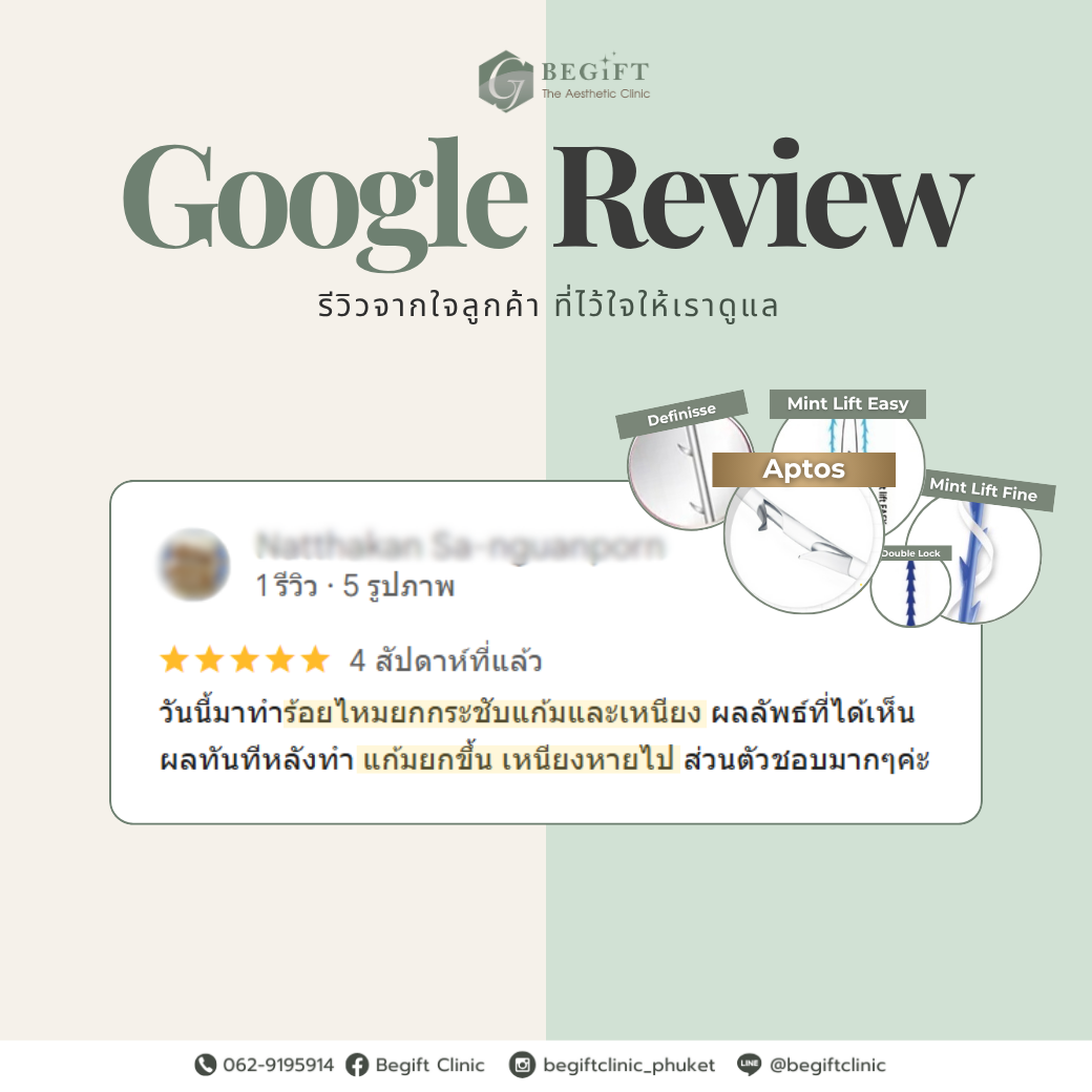 รีวิวร้อยไหม Phuket | Begift Clinic รีวิวร้อยไหมยกกระชับและปรับกรอบหน้า ที่ Begift Clinic Phuket
