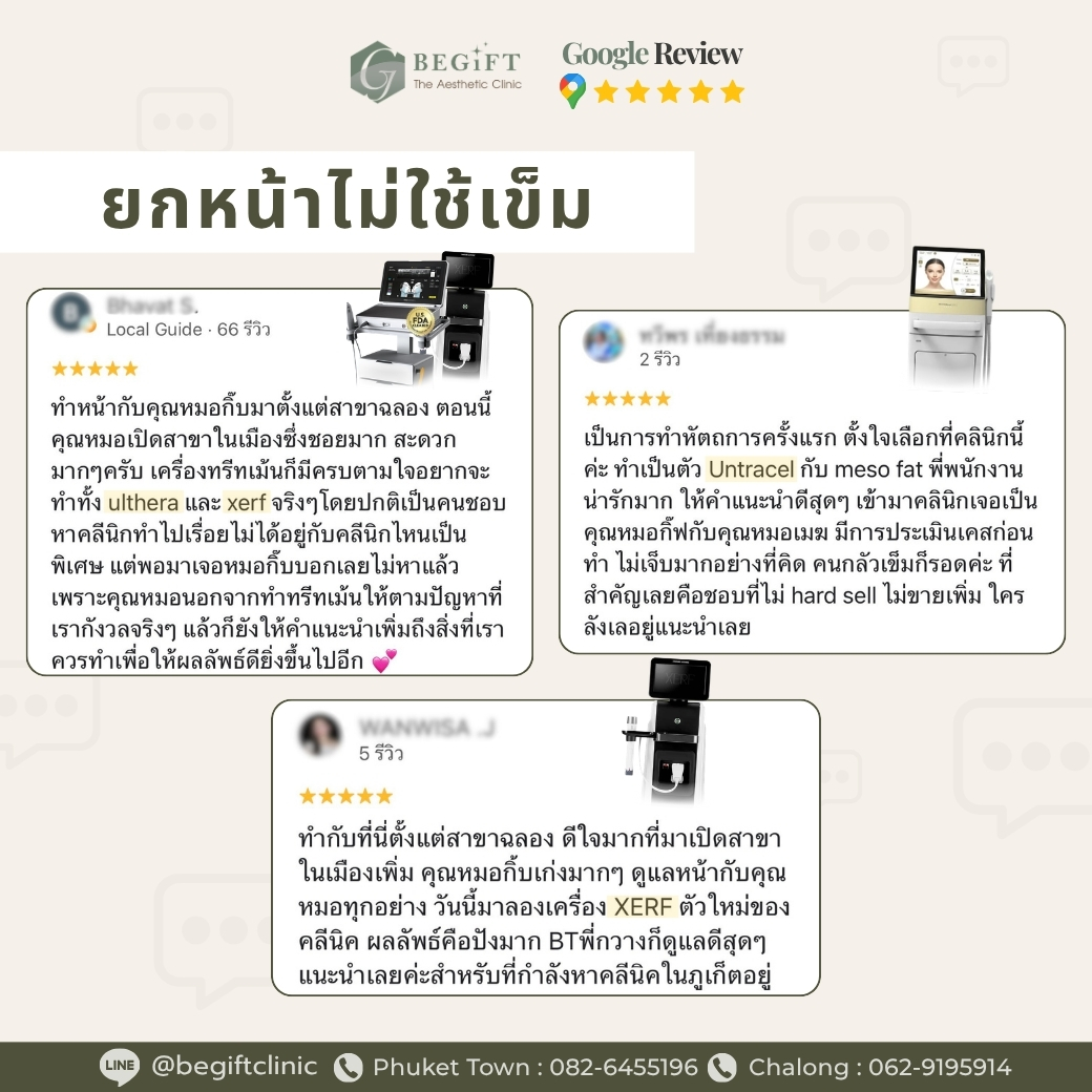 รีวิวยกกระชับแบบไม่ใช้เข็มจากผู้ใช้บริการ Begift Clinic Phuket