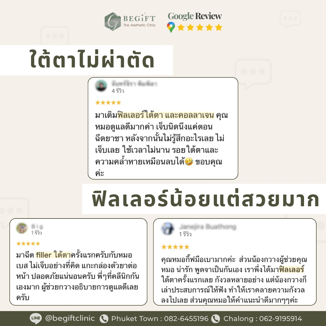 รีวิวการดูแลปัญหาใต้ตาจากผู้ใช้บริการ Begift Clinic Phuket